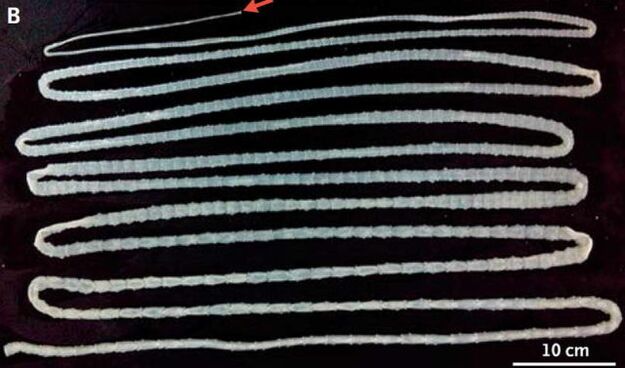 human body tapeworm