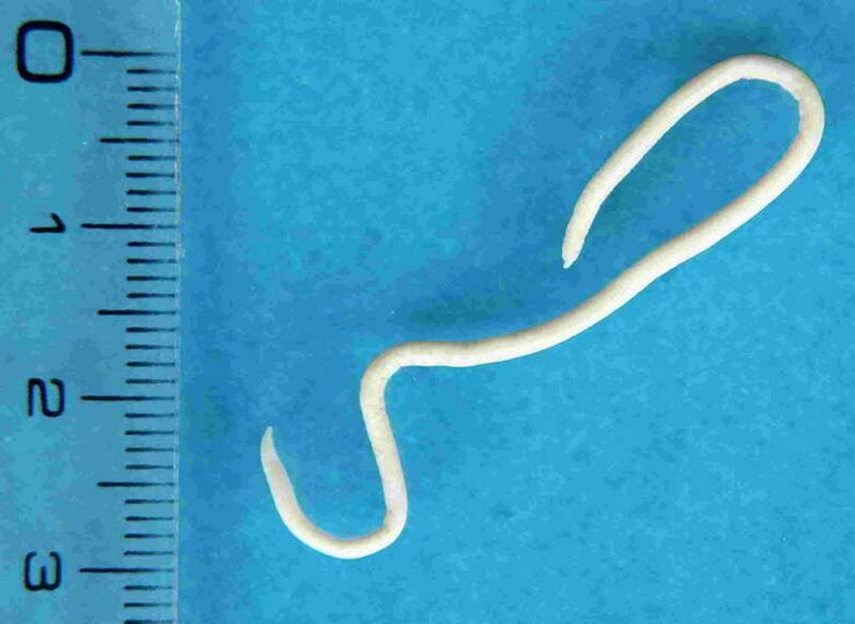 human body worm