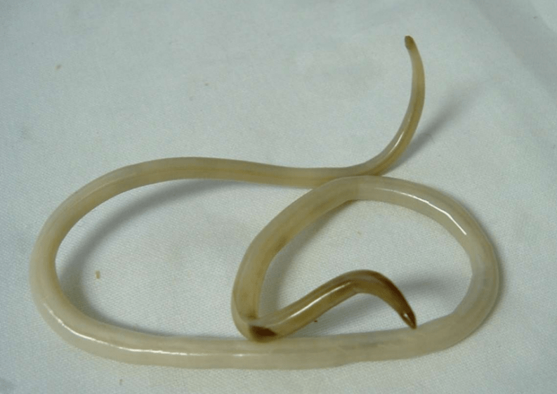 worm of the human body and its treatment